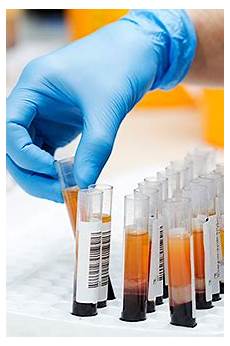 Diagnostic Product