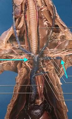 Diaphragm