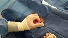 Femoral
