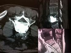 Interventional Materials