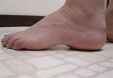Medical Footwear