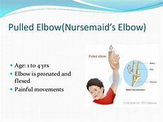 Reducing Elbow